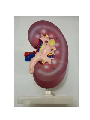 หุ่นจำลองของไตแบบแยกส่วน, โมเดลจำลอง,วิทยาศาสตร์ ,ของเล่นเสริมพัฒนาการ, ของเล่นเด็กประถม, สื่อการสอนเด็กประถม,พร้อมส่ง